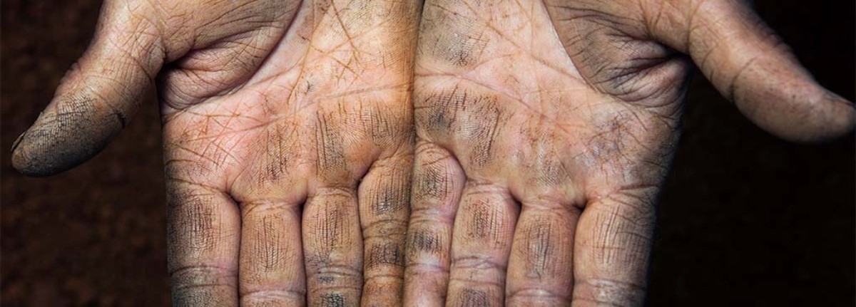 Handverzorging 